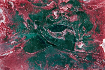 A 276B